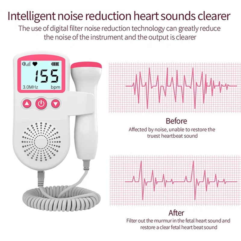 Portable Fetal Doppler – Listen to Your Baby’s Heartbeat at Home