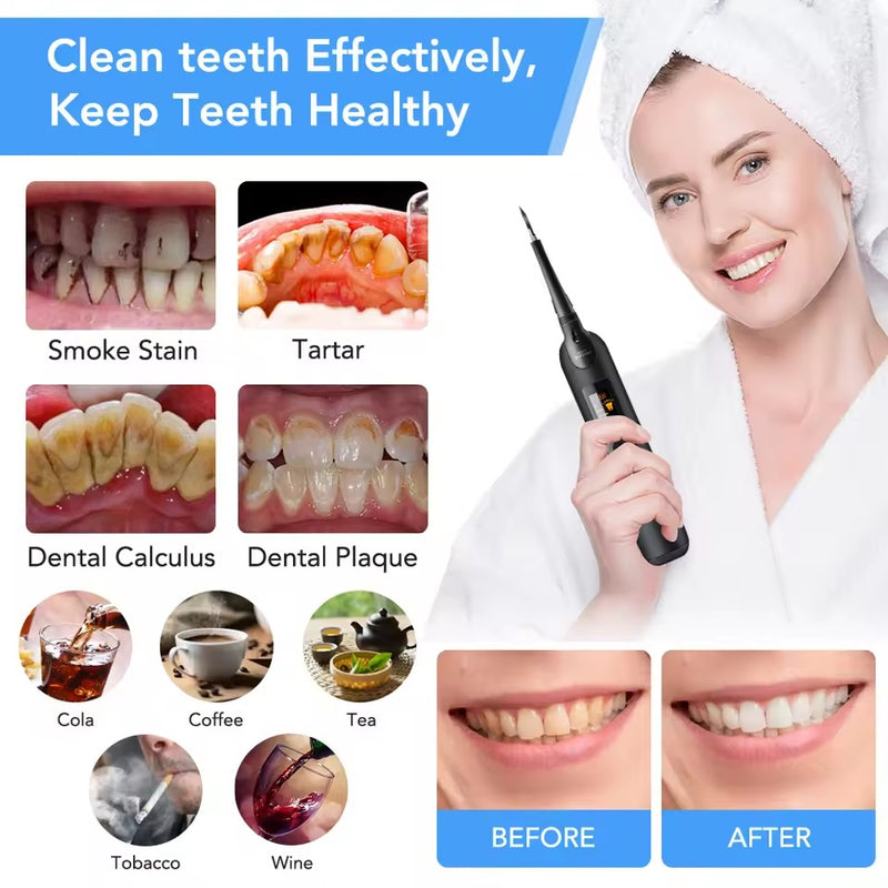 Professional Electric Dental Cleaner for Teeth Whitening