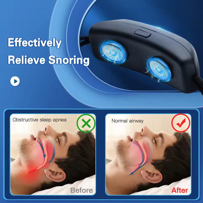 Anti-Snoring Device – Smart Snore Reduction Solution