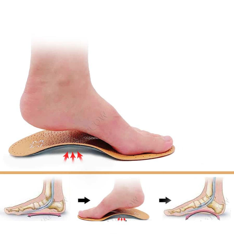 Leather Orthopedic Insoles - Maximum Arch Support Comfort